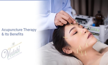 What is Acupuncture Therapy and its Benefits?