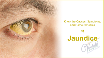 Know the Causes, Symptoms, and Home remedies of Jaundice