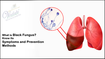 What is Black Fungus or Mucormycosis? Know its Symptoms and Prevention Methods