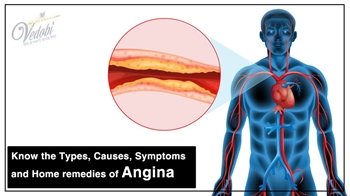 Know the Types, Causes, Symptoms and Home remedies of Angina
