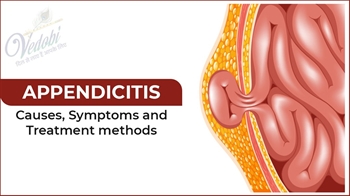 Appendicitis- Causes, Symptoms and Treatment methods