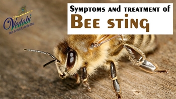 Symptoms and treatment of Bee sting