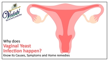 Why does Vaginal Yeast Infection happen? Know its Causes, Symptoms and Home remedies