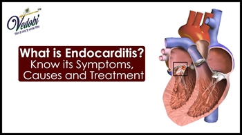 What is Endocarditis? Know its Symptoms, Causes and Treatment