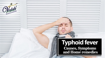 Typhoid fever- Causes, Symptoms and Home remedies