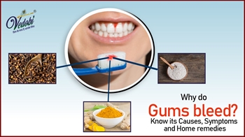 Why do Gums bleed? Know its Causes, Symptoms and Home remedies