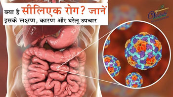 What is Celiac Disease? Know its Symptoms, Causes and Home remedies