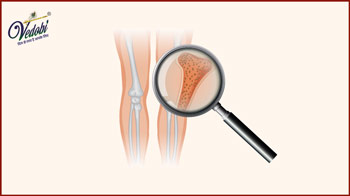 What is Osteopenia? Know its Symptoms, Causes and Treatment methods