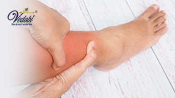 Know the Symptoms, Causes, Diagnosis and Treatment of Edema