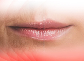 Vedobi Lip Gloss Roll-On 10ML